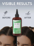 Hair Growth Activator Serum With Menthol & Rosemary Extract - SeasideSPA