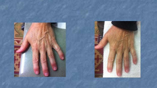 BARKAN cosmetic massage balm for joints - SeasideSPA