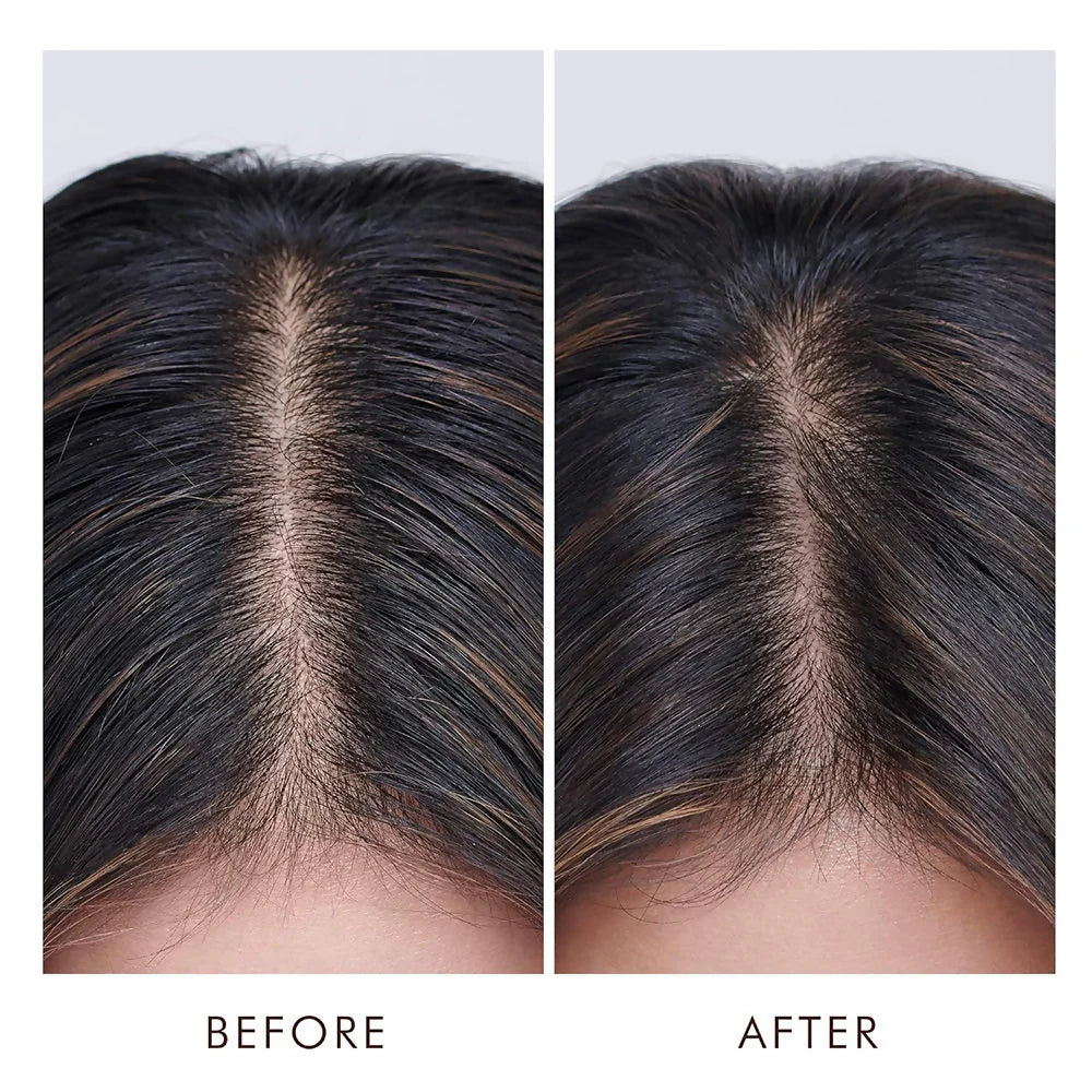 Oily Scalp Treatment - SeasideSPA